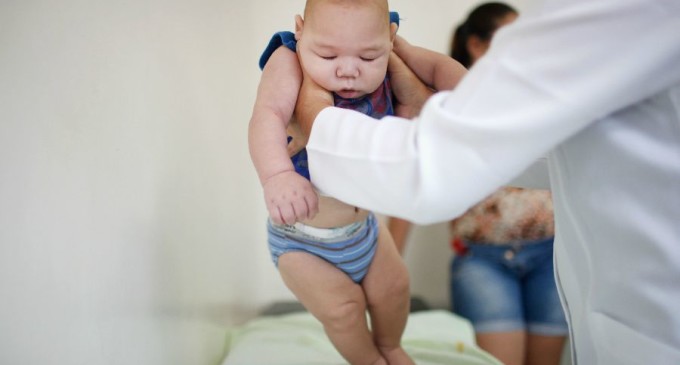 Más de 580 bebés fueron diagnosticados con microcefalia en Brasil