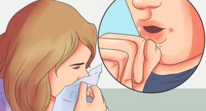 Meningitis se transmite de persona a persona