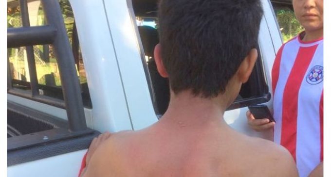 Madre y padrastro del menor que sufrió quemaduras serían procesados