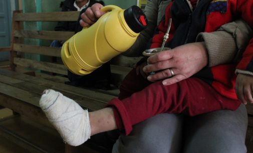 Con el frío casos de quemaduras aumentan: piden extremar cuidados con los niños