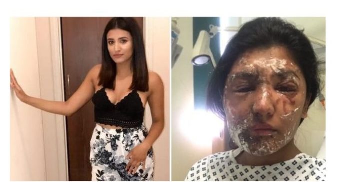 “Hoy me puse de pie y caminé por primera vez sin ayuda”: el diario de Resham Khan, víctima de un ataque con ácido en Londres