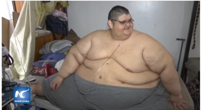 El hombre “más gordo del mundo” ya bajó 218 kilos y ahora sueña con poder caminar