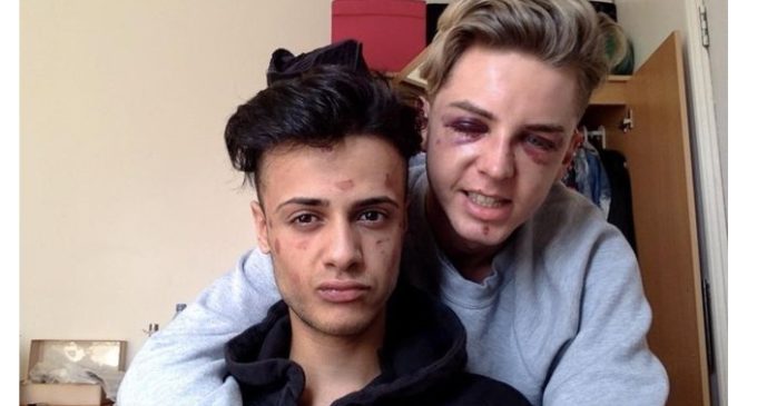 “Casi me dejaron ciego por escoger a la persona que amo”: el dramático relato de parejas gay brutalmente atacadas