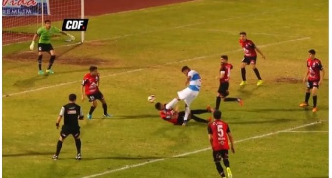 Terrible patada en el fútbol chileno: traumatismo de cráneo y diversas fracturas faciales