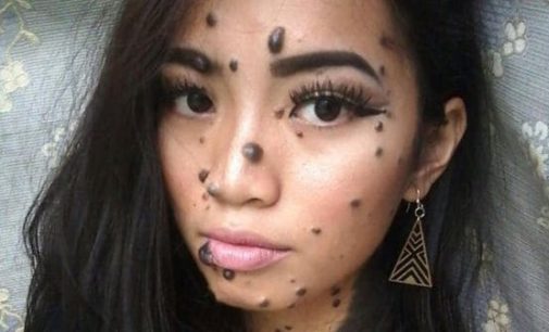 La aspirante a miss universo que deja sin palabras por sus increíbles lunares