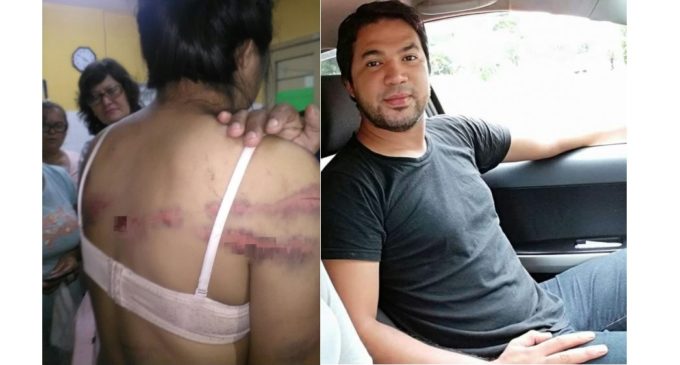 “Le ponía un trapo en la boca y así la sometía a golpes”: Habló la mujer víctima de golpiza por parte de su pareja