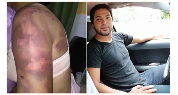 La mujer tiene temor de una represalia desde la cárcel por parte de su concubino, dice abogado