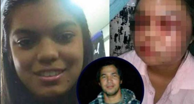 Joven brutalmente golpeada por su novio quiere dar un mensaje a las mujeres paraguayas