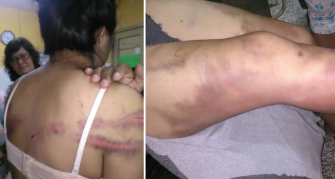 Mujer agredida quedará con cicatrices y trauma psicológico