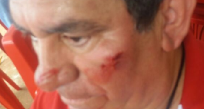 Sospechan intento de atentado contra candidato a gobernador