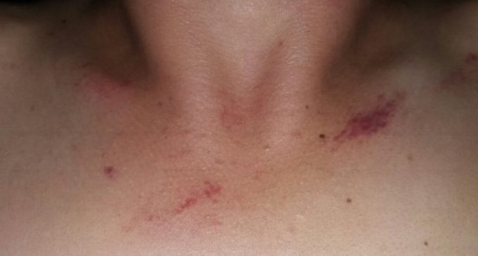 Supuesta tortura de la FTC: Militares dicen que fueron los jóvenes quienes provocaron la gresca