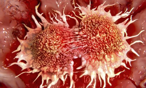 Cáncer de cabeza y cuello deja al menos 22.000 muertos al año en América Latina